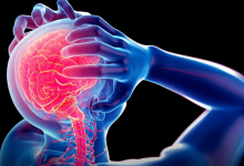 Epilepsi Nedir, Epilepsi Nöbet Çeşitleri Nelerdir